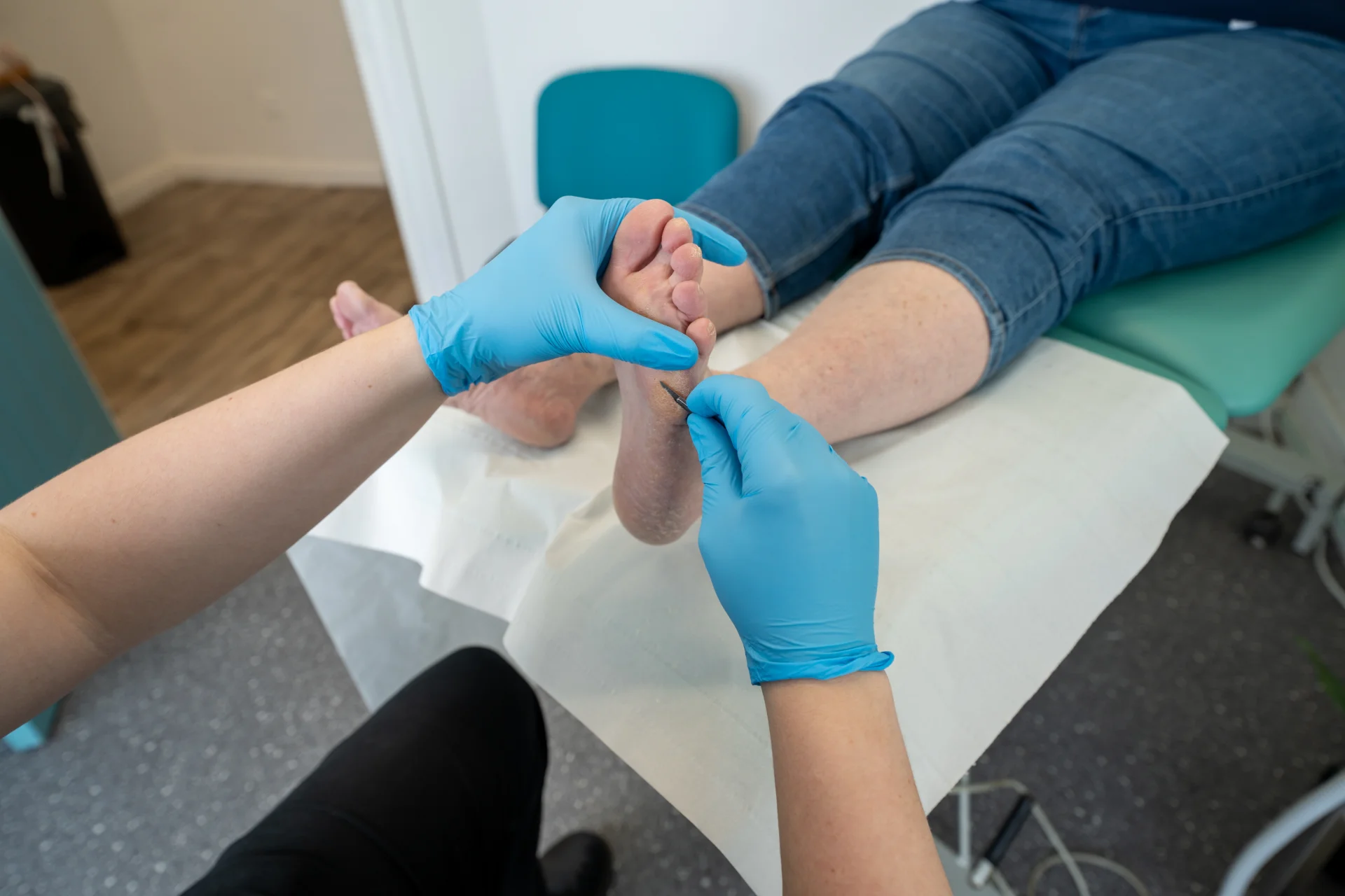 2. Callus Corns Right