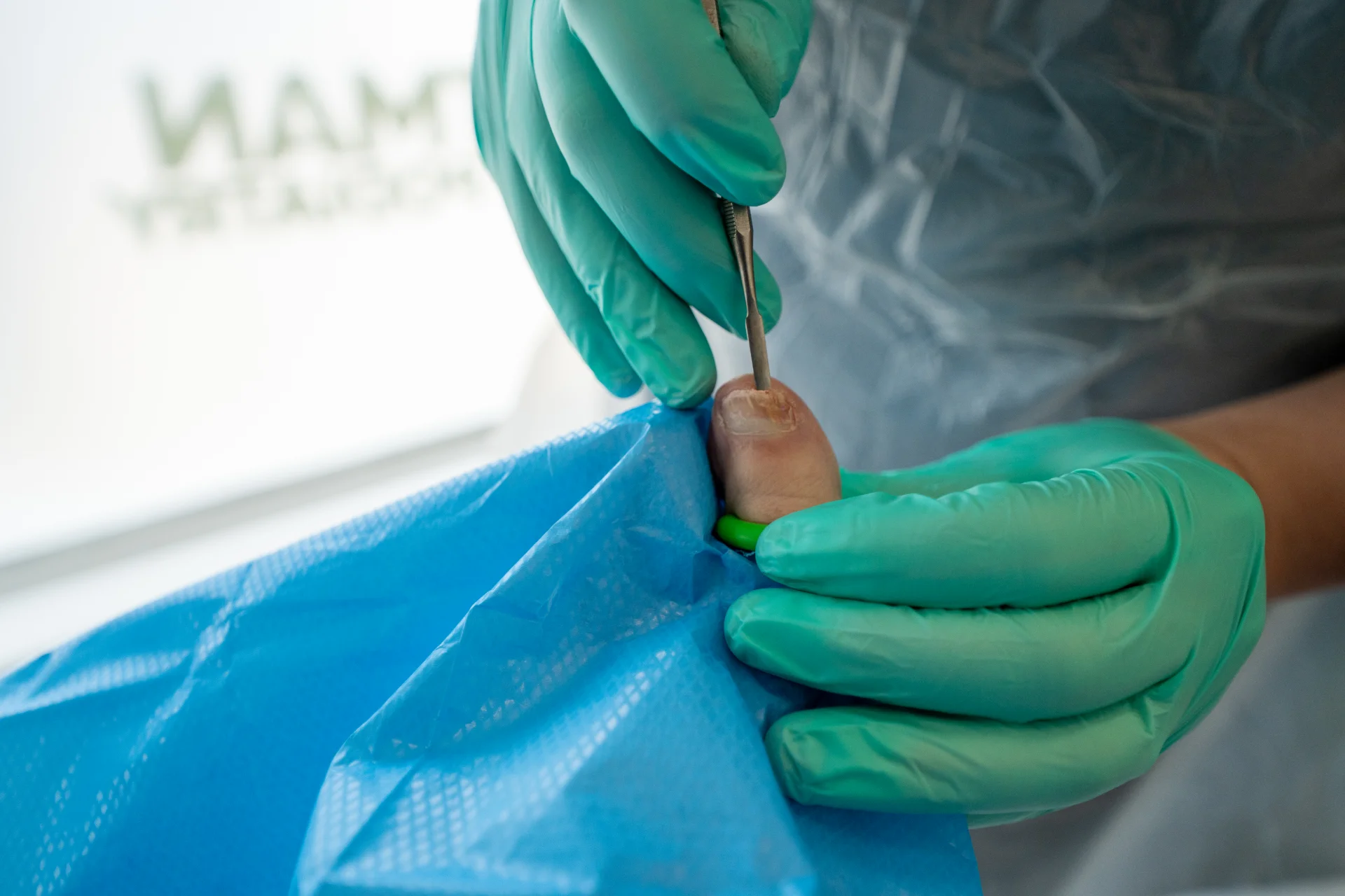 7. Nail Surgery