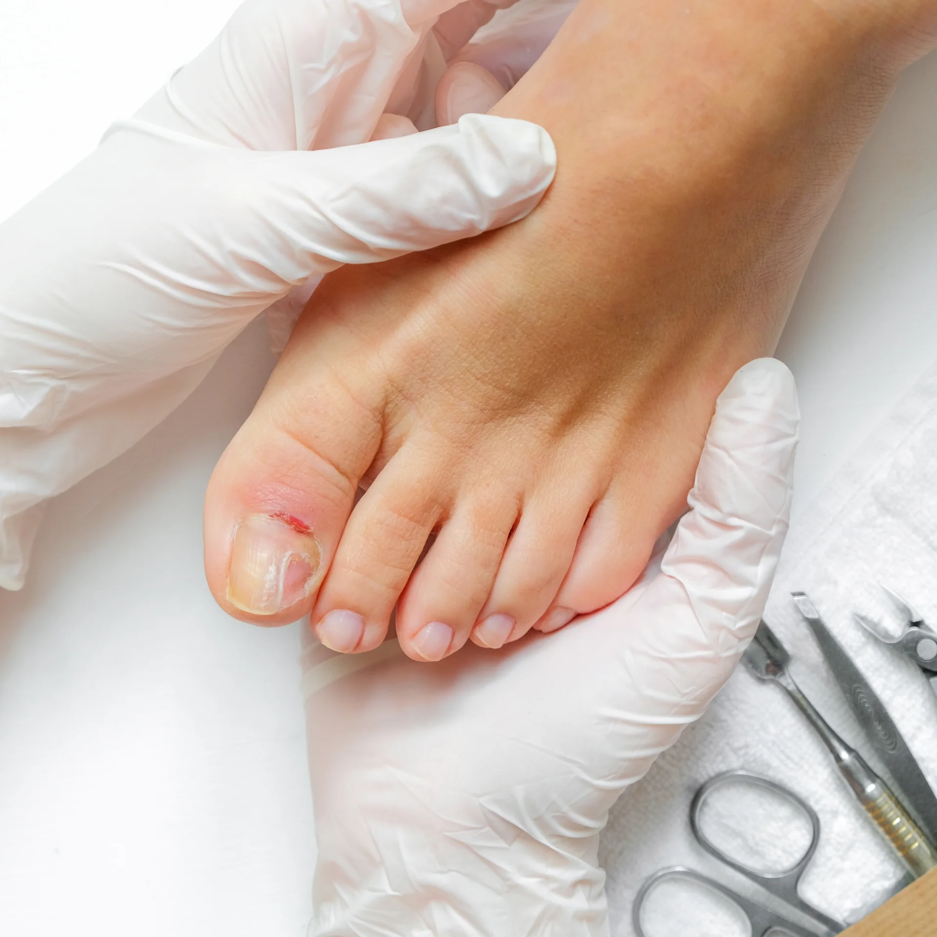 podiatry examines injury on big toe 2026 03 20 06 08 24 utc